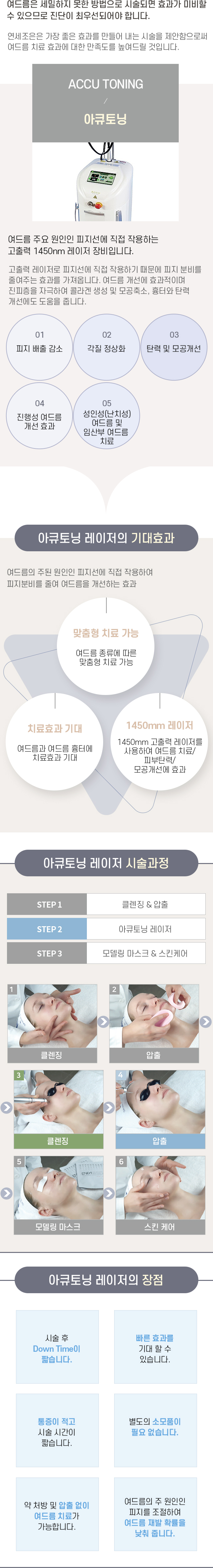 아큐토닝