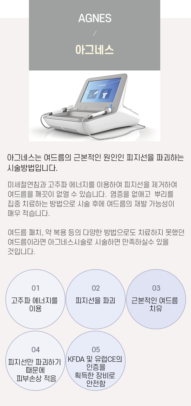 아그네스